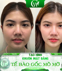 Artboard 101 copy 3